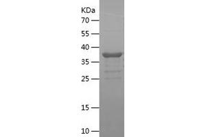 Western Blotting (WB) image for Cyclin-Dependent Kinase Inhibitor 1A (p21, Cip1) (CDKN1A) (AA 2-164) protein (His-IF2DI Tag) (ABIN7122535)
