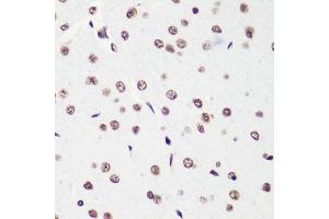 Immunohistochemistry of paraffin-embedded rat brain using H4K20me2 antibody. (Histone H4 antibody  (2meLys20))