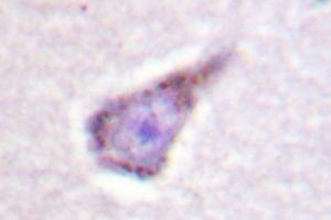 Image no. 2 for anti-Wiskott-Aldrich Syndrome (Eczema-thrombocytopenia) (WAS) antibody (ABIN272092) (WASP antibody)