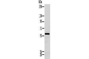 Western blot analysis of Human kidney tissue using ZNF248 Polyclonal Antibody at dilution of 1:200 (ZNF248 antibody)