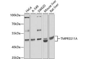 Western blot analysis of extracts of various cell lines, using TMPRSS11A antibody (ABIN6133161, ABIN6149279, ABIN6149281 and ABIN6224715) at 1:1000 dilution.