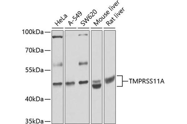 TMPRSS11A Antikörper  (AA 300-421)