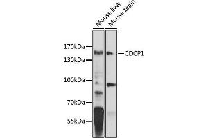 Western blot analysis of extracts of various cell lines, using CDCP1 antibody (ABIN6129363, ABIN6138276, ABIN6138278 and ABIN6224269) at 1:1000 dilution. (CDCP1 antibody  (AA 30-343))