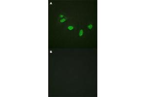Immunofluorescence staining of methanol-fixed HeLa cells with ETS1 (phospho T38) polyclonal antibody  without blocking peptide (A) or preincubated with blocking peptide (B) at 1:100-1:200 dilution. (ETS1 antibody  (pThr38))