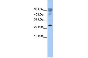 FUNDC1 antibody used at 1 ug/ml to detect target protein. (FUNDC1 antibody  (Middle Region))