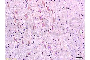 Formalin-fixed and paraffin embedded rat brain tissue labeled with Anti-DRD1 Polyclonal Antibody, Unconjugated (ABIN730843) at 1:300, followed by conjugation to the secondary antibody and DAB staining (Dopamine Receptor d1 antibody  (AA 101-200))