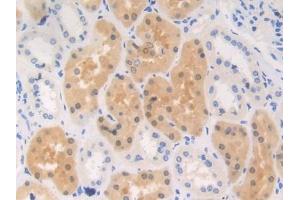 DAB staining on IHC-P; Samples: Human Kidney Tissue (RENBP antibody  (AA 1-254))