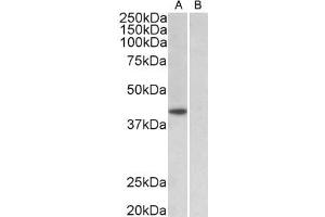 ABIN987280 (1µg/ml) staining of HeLa nuclear (A) and cytosolic (B) lysates (35µg protein in RIPA buffer). (TBP antibody  (AA 39-50))