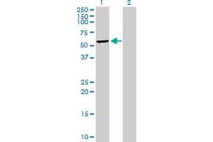 Western Blot analysis of MLKL expression in transfected 293T cell line by MLKL MaxPab polyclonal antibody. (MLKL antibody  (AA 1-471))
