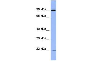 Host:  Rabbit  Target Name:  ZNF780B  Sample Type:  ACHN Whole cell lysates  Antibody Dilution:  1. (ZNF780B antibody  (N-Term))