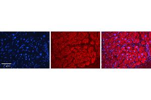 Rabbit Anti-AARS Antibody   Formalin Fixed Paraffin Embedded Tissue: Human heart Tissue Observed Staining: Cytoplasmic Primary Antibody Concentration: N/A Other Working Concentrations: 1:600 Secondary Antibody: Donkey anti-Rabbit-Cy3 Secondary Antibody Concentration: 1:200 Magnification: 20X Exposure Time: 0. (AARS antibody  (N-Term))