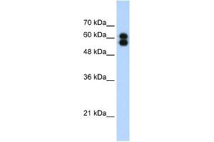 WB Suggested Anti-ALPP Antibody Titration:  1. (PLAP antibody  (C-Term))