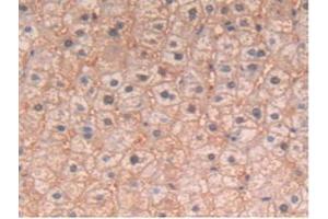 IHC-P analysis of Human Liver Tissue, with DAB staining. (IL-4 antibody)