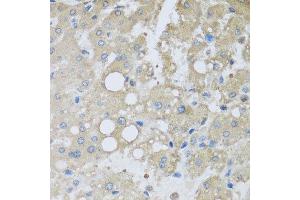 Immunohistochemistry of paraffin-embedded human liver injury using CHMP1B antibody at dilution of 1:100 (x40 lens). (CHMP1B antibody)