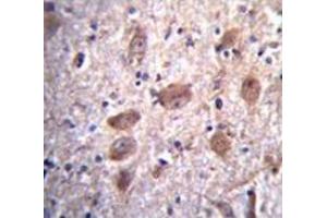 Immunohistochemistry analysis in human brain tissue (Formalin-fixed, Paraffin-embedded) using Paraplegin / SPG7  Antibody , followed by peroxidase conjugation of the secondary antibody and DAB staining. (SPG7 antibody  (Middle Region))