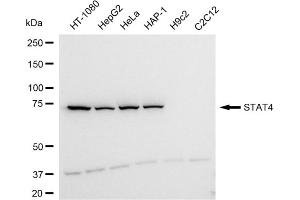Western blotting analysis using STAT4 antibody (ABIN7800346).