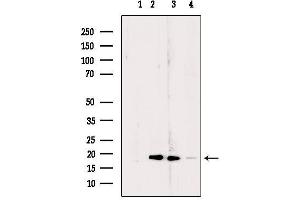 Western blot analysis of extracts from various samples, using RPL24 Antibody. (RPL24 antibody  (Internal Region))