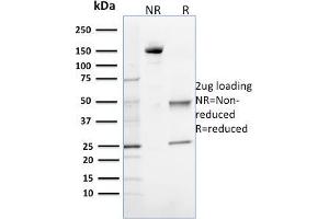 SDS-PAGE Analysis Purified 8-oxoguanine Mouse Monoclonal Antibody (CPTC-OGG1-1). (OGG1 antibody)