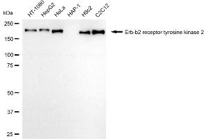 Western blotting analysis using Erb-b2 receptor tyrosine kinase 2 antibody (ABIN7800156). (Recombinant ErbB2/Her2 antibody)