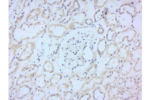 Paraformaldehyde-fixed, paraffin embedded human kidney, Antigen retrieval by boiling in sodium citrate buffer (pH6) for 15min, Block endogenous peroxidase by 3% hydrogen peroxide for 30 minutes, Blocking buffer (normal goat serum) at 37°C for 20min, Antibody incubation with Rabbit Anti-CD244 Polyclonal Antibody, Unconjugated  at 1:200 overnight at 4°C, followed by a conjugated secondary for 90 minutes and DAB staining. (2B4 antibody  (AA 151-250))