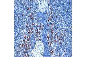 Immunohistochemistry of paraffin-embedded mouse spleen using NAIP Rabbit mAb (ABIN7268931) at dilution of 1:100 (40x lens). (NAIP antibody)