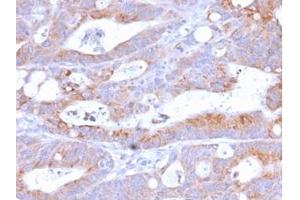 Immunohistochemistry (IHC) image for anti-CD86 (CD86) antibody (ABIN6941145)
