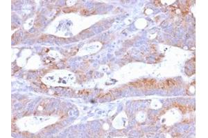 Formalin-fixed, paraffin-embedded human Colon stained with CD86 Rabbit Recombinant Monoclonal Antibody (C86/2160R). (Recombinant CD86 antibody)