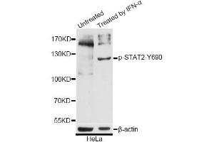 Western blot analysis of extracts of HeLa cells, using Phospho-STAT2-Y690 antibody (ABIN5969951) at 1/2000 dilution. (STAT2 antibody  (pTyr690))