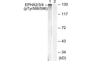 Western Blotting (WB) image for anti-Eph Receptor A2+A3 (EPHA2/3) (pTyr588), (pTyr596) antibody (ABIN1847362) (EPHA2/3 antibody  (pTyr588, pTyr596))