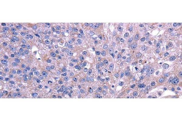 TRIM49 antibody