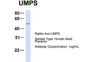 Host:  Rabbit  Target Name:  UMPS  Sample Type:  Human Adult Placenta  Antibody Dilution:  1. (UMPS antibody  (C-Term))