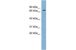 WB Suggested Anti-SLC7A2 Antibody Titration:  0. (SLC7A2 antibody  (Middle Region))