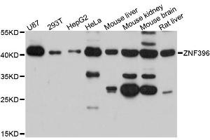 Western blot analysis of extracts of various cell lines, using ZNF396 antibody (ABIN6291098) at 1:3000 dilution. (ZNF396 antibody)