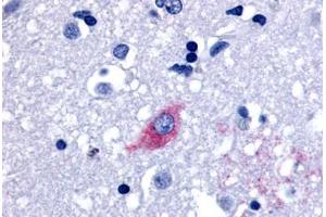 Anti-LGR4 antibody  ABIN1049003 IHC staining of human brain, neurons and glia. (LGR4 antibody  (Cytoplasmic Domain))