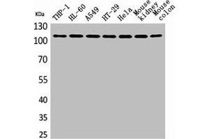 Western Blot analysis of THP-1 H460 A549 HT29 HeLa mouse kidney mouse colon cells using cPLA2 Polyclonal Antibody (PLA2G4A antibody  (N-Term))
