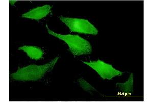 Immunofluorescence of monoclonal antibody to TNFSF11 on HeLa cell. (RANKL antibody  (AA 222-316))