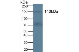 Western blot analysis of Human Blood Cells. (KIT antibody  (AA 321-520))