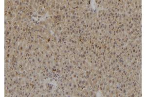 ABIN6269361 at 1/100 staining Rat liver tissue by IHC-P.