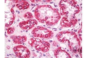Immunohistochemistry (IHC) image for anti-Apoptosis-Inducing Factor, Mitochondrion-Associated, 1 (AIFM1) (AA 151-180) antibody (ABIN1099879)