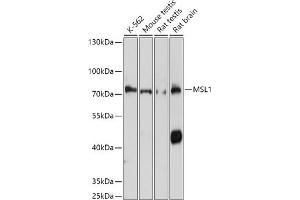 Western blot analysis of extracts of various cell lines, using MSL1 antibody (ABIN7268383) at 1:1000 dilution. (MSL1 antibody  (AA 210-300))