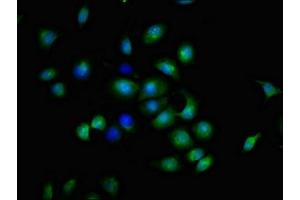 Immunofluorescent analysis of A549 cells using ABIN7173895 at dilution of 1:100 and Alexa Fluor 488-congugated AffiniPure Goat Anti-Rabbit IgG(H+L) (CD137 antibody  (AA 24-186))