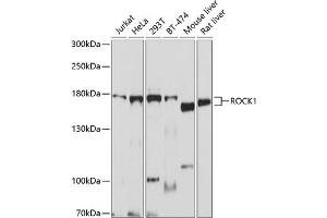 Western blot analysis of extracts of various cell lines, using ROCK1 antibody  at 1:1000 dilution. (ROCK1 antibody)