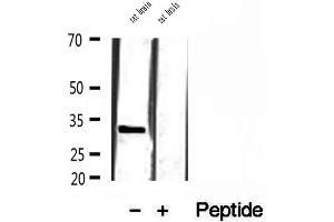 Western blot analysis of extracts of rat brain tissue, using SULT4A1 antibody. (SULT4A1 antibody  (C-Term))