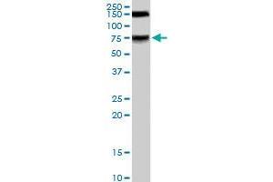 MELK polyclonal antibody  staining (0. (MELK antibody)