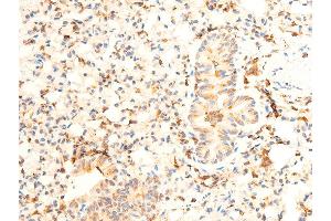 ABIN6267072 at 1/100 staining mouse lung tissue sections by IHC-P. (JAK1 antibody  (pTyr1022, pTyr1023))