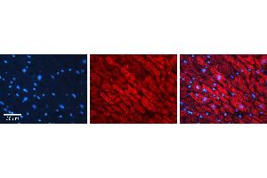 Rabbit Anti-CALR Antibody Catalog Number: ARP58123_P050 Formalin Fixed Paraffin Embedded Tissue: Human heart Tissue Observed Staining: Plasma membrane in intercalated disk Primary Antibody Concentration: 1:100 Other Working Concentrations: 1:600 Secondary Antibody: Donkey anti-Rabbit-Cy3 Secondary Antibody Concentration: 1:200 Magnification: 20X Exposure Time: 0. (Calreticulin antibody  (N-Term))