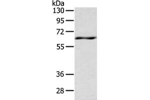 Gel: 8 % SDS-PAGE, Lysate: 80 μg, Lane: Mouse spleen tissue, Primary antibody: ABIN7191331(LZTS1 Antibody) at dilution 1/200 dilution, Secondary antibody: Goat anti rabbit IgG at 1/8000 dilution, Exposure time: 10 seconds (LZTS1 antibody)