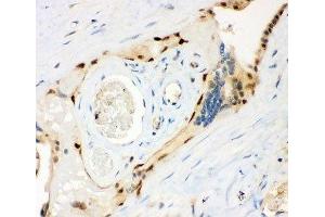 IHC-P: MSK1 antibody testing of human placenta tissue