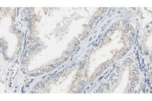 ABIN6267468 at 1/100 staining Human prostate tissue by IHC-P. (CDC25B antibody  (pSer353))