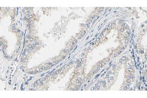 ABIN6267468 at 1/100 staining Human prostate tissue by IHC-P.